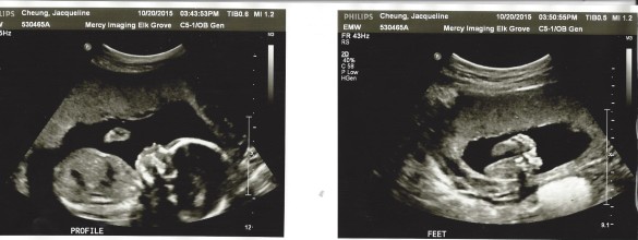 Ultrasound 10-20-15