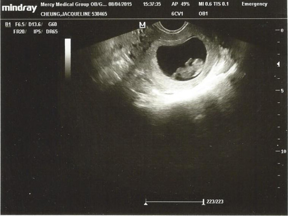 Ultrasound 8-4-15