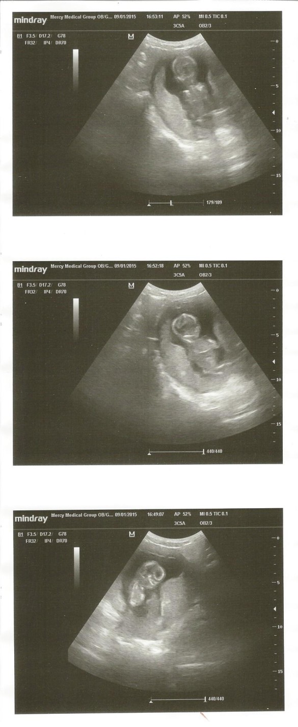 Ultrasound 9-1-15